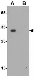 Anti-RILP antibody used in Western Blot (WB). GTX32069
