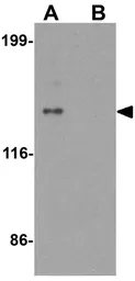 Anti-ZNF521 antibody used in Western Blot (WB). GTX32072