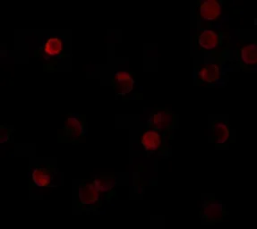 Anti-ZNF521 antibody used in Immunocytochemistry/ Immunofluorescence (ICC/IF). GTX32072