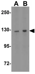 Anti-ZNF687 antibody used in Western Blot (WB). GTX32073