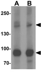 Anti-VPS13B antibody used in Western Blot (WB). GTX32078