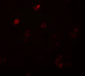 Anti-CCDC22 antibody used in IHC (Paraffin sections) (IHC-P). GTX32079