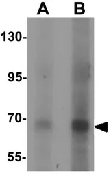 Anti-CCDC22 antibody used in Western Blot (WB). GTX32079