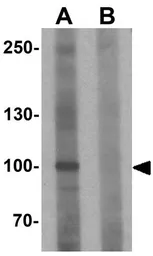 Anti-FAM193B antibody used in Western Blot (WB). GTX32081