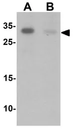 Anti-TCTEX1D1 antibody used in Western Blot (WB). GTX32084