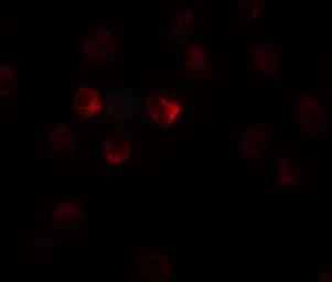 Anti-TCTEX1D1 antibody used in Immunocytochemistry/ Immunofluorescence (ICC/IF). GTX32084