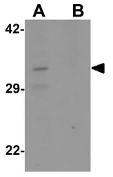 Anti-CLEC2A antibody used in Western Blot (WB). GTX32085