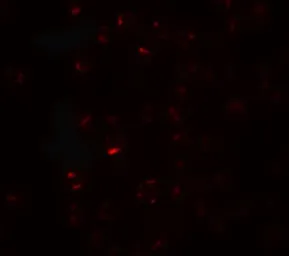 Anti-CLEC2A antibody used in Immunocytochemistry/ Immunofluorescence (ICC/IF). GTX32085