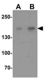 Anti-CRIM2 antibody used in Western Blot (WB). GTX32086