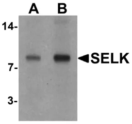 Anti-SELK antibody used in Western Blot (WB). GTX32088