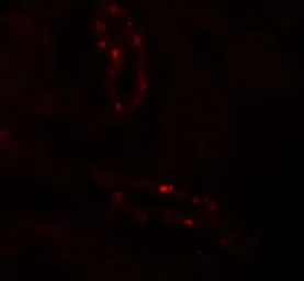 Anti-SCUBE3 antibody used in IHC (Paraffin sections) (IHC-P). GTX32089