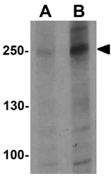 Anti-ATG2B antibody used in Western Blot (WB). GTX32090