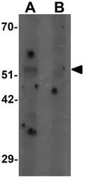 Anti-SHQ1 antibody used in Western Blot (WB). GTX32091