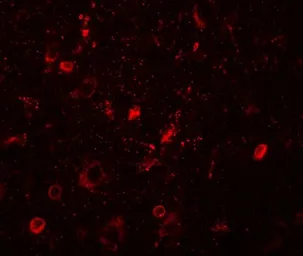 Anti-SGSM1 antibody used in IHC (Paraffin sections) (IHC-P). GTX32093