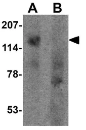 Anti-SGSM1 antibody used in Western Blot (WB). GTX32093