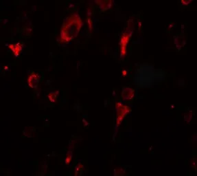 Anti-SGSM2 antibody used in IHC (Paraffin sections) (IHC-P). GTX32094
