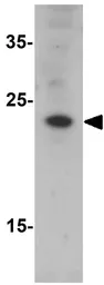 Anti-CHCHD6 antibody used in Western Blot (WB). GTX32100