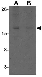 Anti-CHCHD7 antibody used in Western Blot (WB). GTX32101