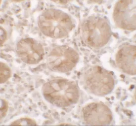 Anti-SHISA3 antibody used in IHC (Paraffin sections) (IHC-P). GTX32109