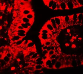 Anti-SHISA3 antibody used in IHC (Paraffin sections) (IHC-P). GTX32109