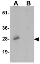Anti-SHISA3 antibody used in Western Blot (WB). GTX32109