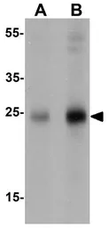 Anti-SHISA4 antibody used in Western Blot (WB). GTX32110