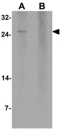 Anti-MOSPD1 antibody used in Western Blot (WB). GTX32111