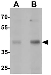 Anti-MTERFD1 antibody used in Western Blot (WB). GTX32112