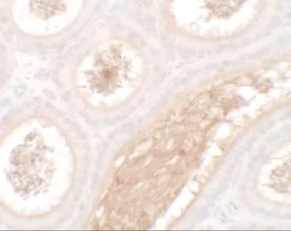 Anti-WAC antibody used in IHC (Paraffin sections) (IHC-P). GTX32115