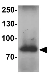 Anti-WAC antibody used in Western Blot (WB). GTX32115