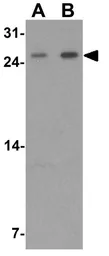 Anti-KHDC1 antibody used in Western Blot (WB). GTX32118
