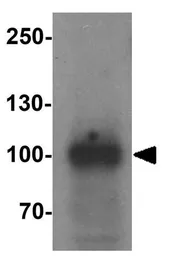 Anti-PHF14 antibody used in Western Blot (WB). GTX32120