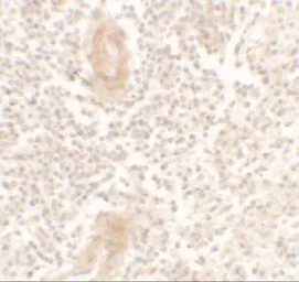 Anti-IL1F10 antibody used in IHC (Paraffin sections) (IHC-P). GTX32121