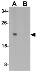 Anti-IL1F10 antibody used in Western Blot (WB). GTX32121