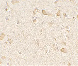 Anti-LC3C antibody used in IHC (Paraffin sections) (IHC-P). GTX32125