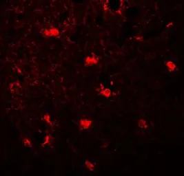 Anti-LC3C antibody used in IHC (Paraffin sections) (IHC-P). GTX32125