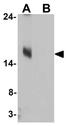 Anti-LC3C antibody used in Western Blot (WB). GTX32125
