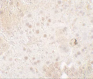 Anti-TMIGD1 antibody used in IHC (Paraffin sections) (IHC-P). GTX32126