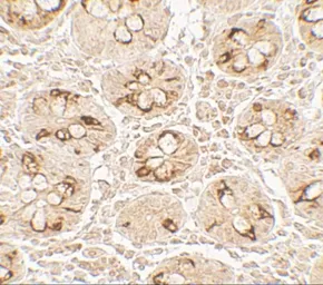 Anti-TMIGD2 antibody used in IHC (Paraffin sections) (IHC-P). GTX32127
