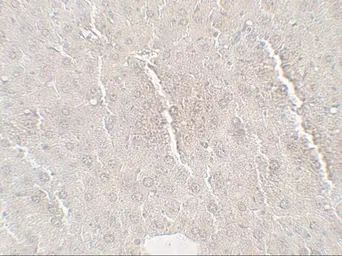Anti-C19orf80 antibody used in IHC (Paraffin sections) (IHC-P). GTX32128