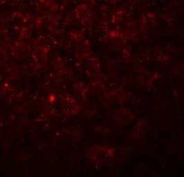 Anti-C19orf80 antibody used in IHC (Paraffin sections) (IHC-P). GTX32128
