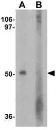 Anti-GDPD5 antibody used in Western Blot (WB). GTX32133
