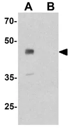Anti-UBIAD1 antibody used in Western Blot (WB). GTX32134