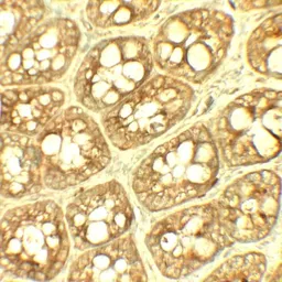 Anti-TRIP12 antibody used in IHC (Paraffin sections) (IHC-P). GTX32138