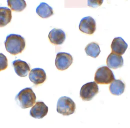 Anti-TRIP12 antibody used in Immunocytochemistry/ Immunofluorescence (ICC/IF). GTX32138