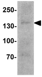 Anti-IQSEC2 antibody used in Western Blot (WB). GTX32143