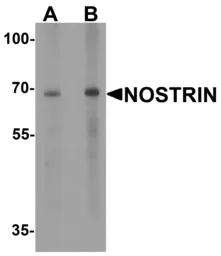 Anti-NOSTRIN antibody used in Western Blot (WB). GTX32144