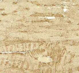 Anti-MYH8 antibody used in IHC (Paraffin sections) (IHC-P). GTX32145