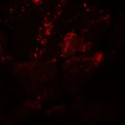 Anti-MYH8 antibody used in IHC (Paraffin sections) (IHC-P). GTX32145