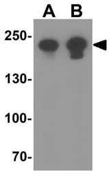 Anti-MYH8 antibody used in Western Blot (WB). GTX32145